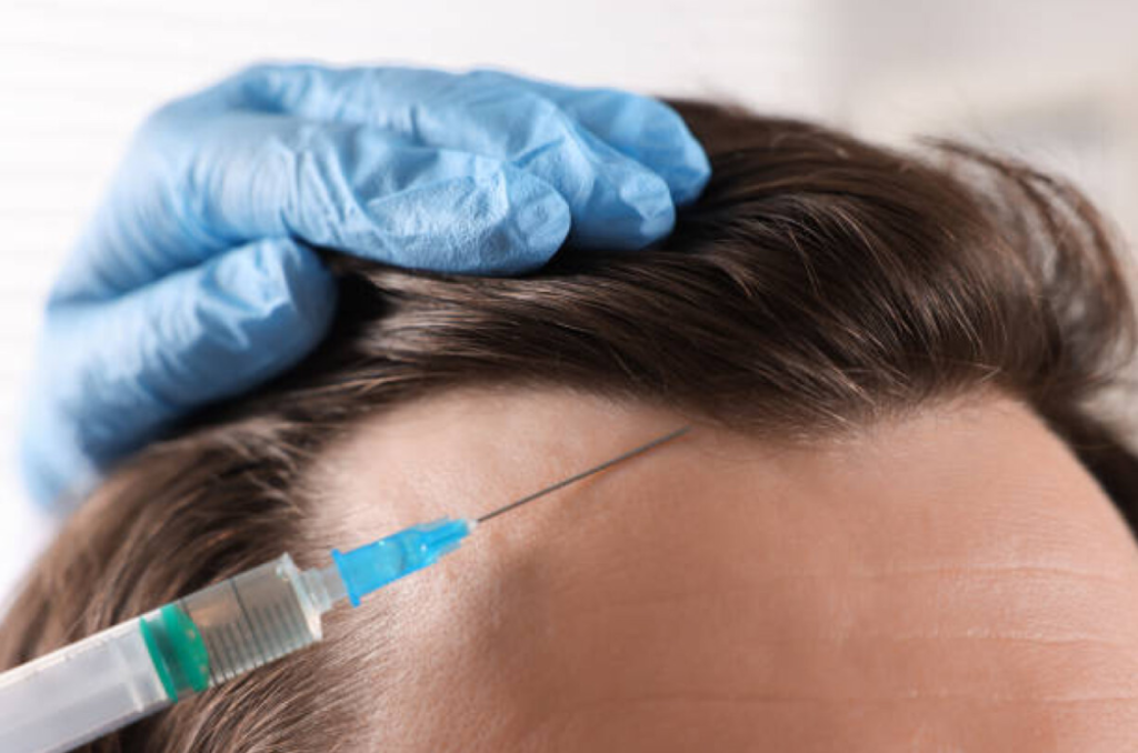 Hair Transplant Market